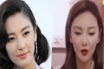 'Bản sao Song Hye Kyo' thừa nhận thẩm mỹ, gương mặt giờ đây nhọn hoắt đến khó lòng nhận ra