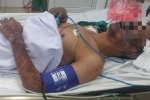 Thái Bình: 50 người bị ngộ độc sau khi ăn tiết canh lợn rừng