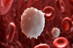 Ung thư máu: Những dấu hiệu nhận biết sớm