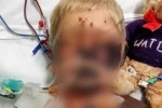 Cậu bé 4 tuổi tưởng bị cảm cúm, không ngờ mắc bệnh nguy hiểm, chết sau 13 ngày nằm viện