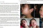 Mẹ trẻ 16 tuổi lên Facebook cầu cứu vì bị chồng bạo hành: Lại một LỜI RU BUỒN cho 'lá diêu bông'