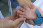 Virus tay chân miệng từng khiến hơn 100 trẻ tử vong nguy hiểm thế nào?