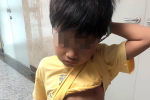 Bé trai 7 tuổi nôn ra đầy bát máu vì căn bệnh vô cùng hiểm ác