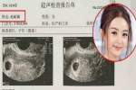 Triệu Lệ Dĩnh lộ giấy khám thai tràn lan trên MXH, tháng 3 năm sau sẽ sinh em bé?