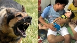 Bé trai 2 tuổi bị chó becgie 40 kg cắn rạn sọ