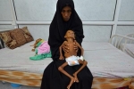 Yemen đứng trước 'nạn đói kinh hoàng nhất lịch sử nhân loại'