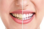 5 tác nhân khiến hàm răng trắng sáng trở nên ố vàng