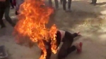 Thiếu nữ 17 tuổi bị người yêu thiêu cháy như ngọn đuốt vì ghen tuông