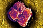 Vì sao tế bào ung thư sinh sôi và di căn nhanh bất thường?
