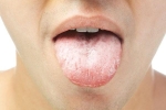Những dấu hiệu bất thường ở lưỡi cảnh báo bệnh