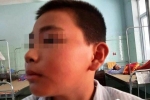 Cậu bé Quảng Bình sợ hãi kể lại giây phút bị cô giáo phạt 231 cái tát đến nhập viện