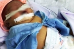 Bé gái nặng 4kg nhưng cho sinh thường ở Bình Thuận bị tổn thương thần kinh cánh tay và hôn mê