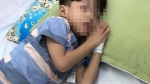 Vụ bé trai 5 tuổi bị chó cắn ở Quảng Nam: T.ử v.ong không phải do bệnh dại