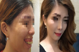 Mở băng sau cắt hàm, nữ công nhân không tin vào gương mặt mình