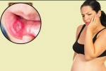 Những nguy hiểm tới sức khỏe của mẹ và thai nhi khi bà bầu nhiệt miệng