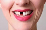 Tại sao con người chỉ mọc lại răng một lần?