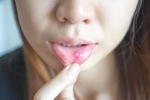 9 dấu hiệu cảnh báo ung thư miệng bạn không nên bỏ qua