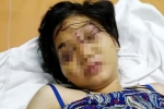 21 ngày sống trong 'địa ngục' của cô gái 9X bị tra tấn đến sẩy thai