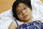 TP.HCM: Cô gái 18 tuổi bị tra tấn man rợ vẫn la hét, kích động mạnh