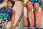 Vụ cô gái 18 tuổi bị tra tấn đến sẩy thai ở Bình Chánh: Giám định ADN thai nhi