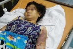 Vụ tra tấn cô gái ở Bình Chánh: Khởi tố nghi can cầm đầu