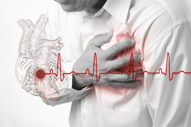 Sức khỏe - Dấu hiệu cảnh báo tim của bạn đã gặp nguy hiểm (Hình 3).