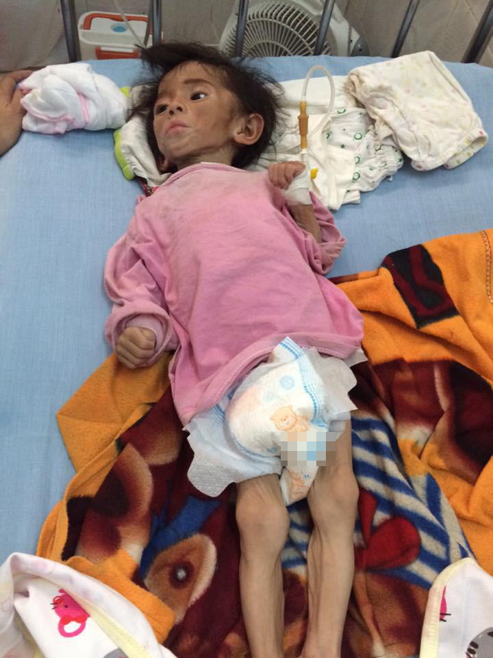 Hình ảnh mới nhất về bé gái suy dinh dưỡng ở Lào Cai được nhận ...