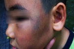 Bé 7 tuổi bị đánh vì nghi trộm gà: Tâm sự người cha