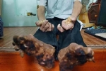 Bệnh 'người cây' hiếm gặp đã được ghi nhận ở Việt Nam