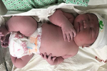 Em bé Hà Nội chào đời nặng 5,2 kg