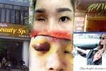 Bắc Giang: Nâng mũi tại cơ sở làm đẹp, cô gái bị mù vĩnh viễn