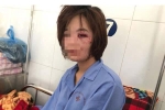 Nữ phụ xe buýt bị hành hung cảm thấy tổn thương vì bị đánh vào ngày 20/10