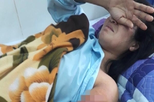Cô giáo ở Gia Lai vượt 130 km đi dạy học, bị tai nạn phải cắt bỏ cánh tay được chuyển về dạy ở gần nhà