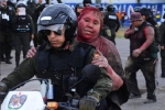 Thị trưởng Bolivia bị người biểu tình cắt tóc, kéo lê trên phố