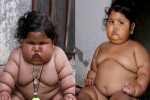 8 tháng tuổi đã gần 20 kg, cuộc sống của bé gái nặng ký nhất Ấn Độ hiện tại như thế nào sau 3 năm phát triển với tốc độ chóng mặt