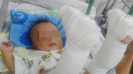 TP.HCM: Bé trai 4 tháng tuổi nghi bị cha ruột b.ạo hành đếngãy 2 chân, người mẹ viết đơn cầu cứu