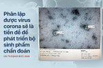 Phân lập virus corona là gì? Ý nghĩa như thế nào đối với tình hình dịch bệnh?