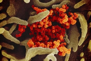 WHO công bố kết quả phân tích mức độ nguy hiểm của virus corona