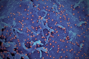 Đây là hình chụp virus corona chủng mới dưới kính hiển vi