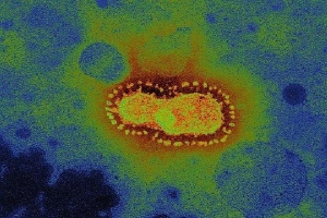 Trung Quốc tìm thấy virus corona trong nước tiểu của bệnh nhân