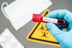 Cộng hòa Séc xác nhận 3 trường hợp nhiễm virus SARS-CoV-2 đầu tiên