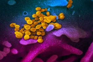 Phát hiện mới về virus corona, mở cơ hội cho vắcxin duy nhất