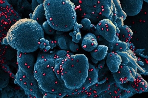 Hình ảnh virus nCoV từng bước bám và giết tế bào dưới kính hiển vi
