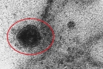 Khoảnh khắc nCoV lây nhiễm tế bào khỏe mạnh
