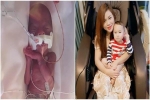 Mẹ Việt ở Mỹ sinh non 5 tháng nặng 6 lạng, con 2,5 tuổi không ai nhận ra