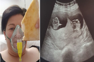 Tỉnh dậy sau 10 ngày hôn mê, người phụ nữ ngỡ ngàng khi biết mình đã đánh bại virus SARS-CoV-2 và còn mang thai một cặp song sinh