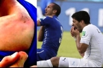 Chiellini: 'Suarez đã đúng khi cắn tôi tại World Cup 2014'