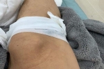 Hoài Linh đăng tải hình ảnh chân trái băng bó khiến nhiều người lo lắng