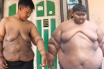 'Cậu bé nặng nhất thế giới' thay đổi nhờ giảm cân, cắt bỏ da thừa
