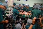 Xúc động từng khoảnh khắc trong ca phẫu thuật tách rời hai bé dính nhau: Cuộc đại phẫu cân não của 5 ê-kíp bác sĩ